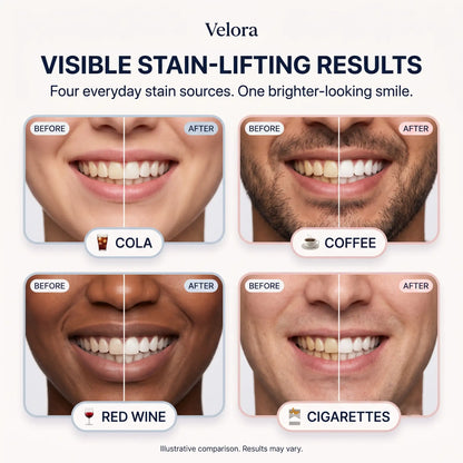 Velora™ Niacinamide Toothpaste